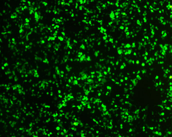 免疫荧光+细胞转染